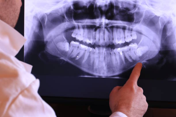 Best Emergency Treatment for Toothache in Adel, IA